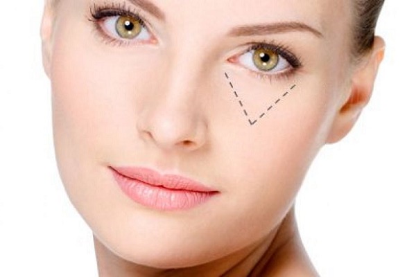 Những lưu ý để ngăn ngừa sự hình thành nếp nhăn vùng mắt